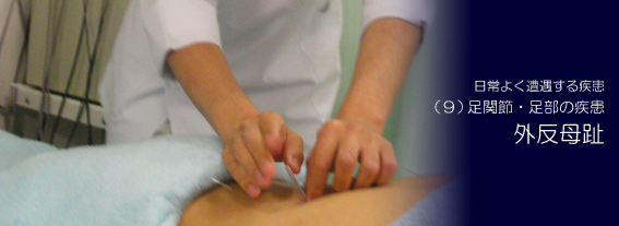 �O������