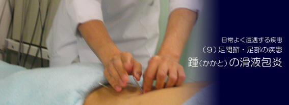 踵(かかと)の滑液包炎