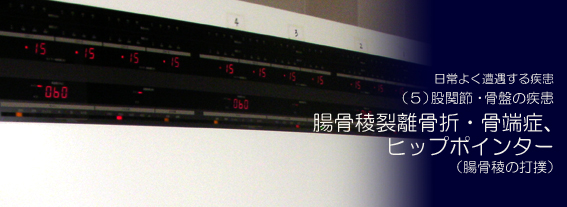 �����ŗ������܁E���[�ǁA�q�b�v�|�C���^�[�i�����ł̑Ŗo�j